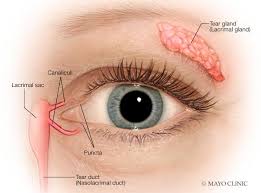 Dry Eye Symptoms
