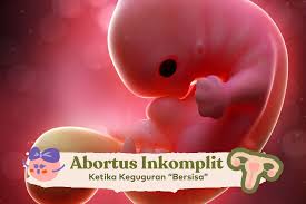incomplete abortion incomplete combustion incomplete miscarriage incomplete penetrance